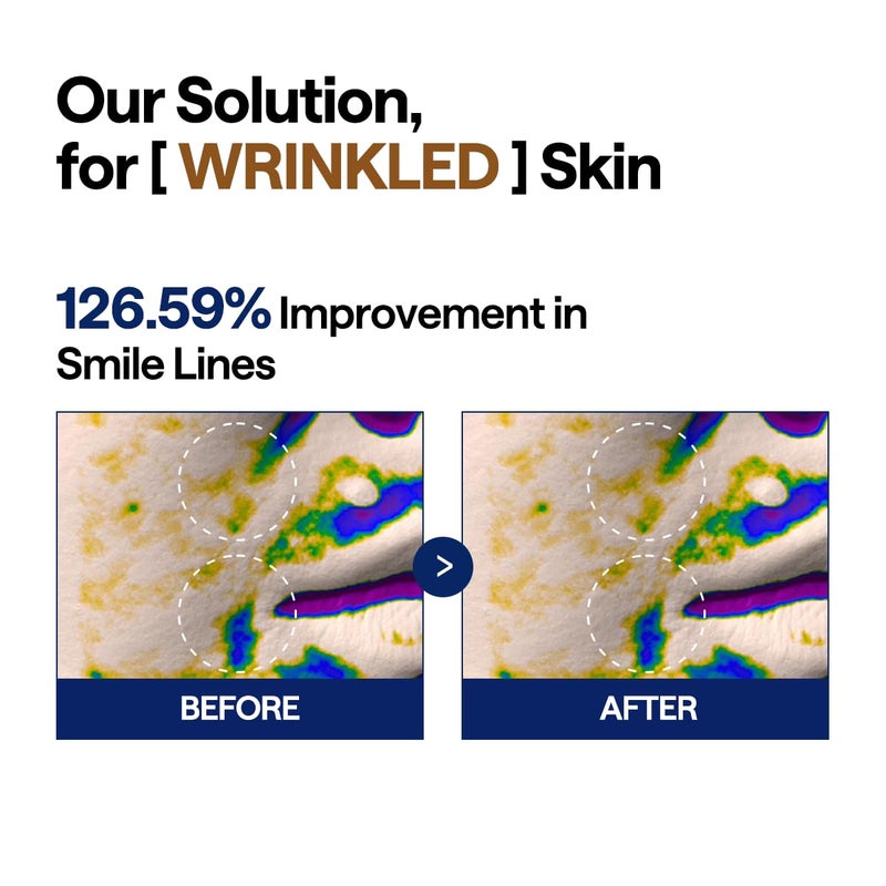 MEDIHEAL وسادة ميديهيال لرفع الكولاجين بالريتينول - وسادات وجه نباتية مضادة للحساسية مع الريتينول والكولاجين - وسادات رفع لتعزيز نسيج البشرة ومرونتها 100 وسادة - Image 4