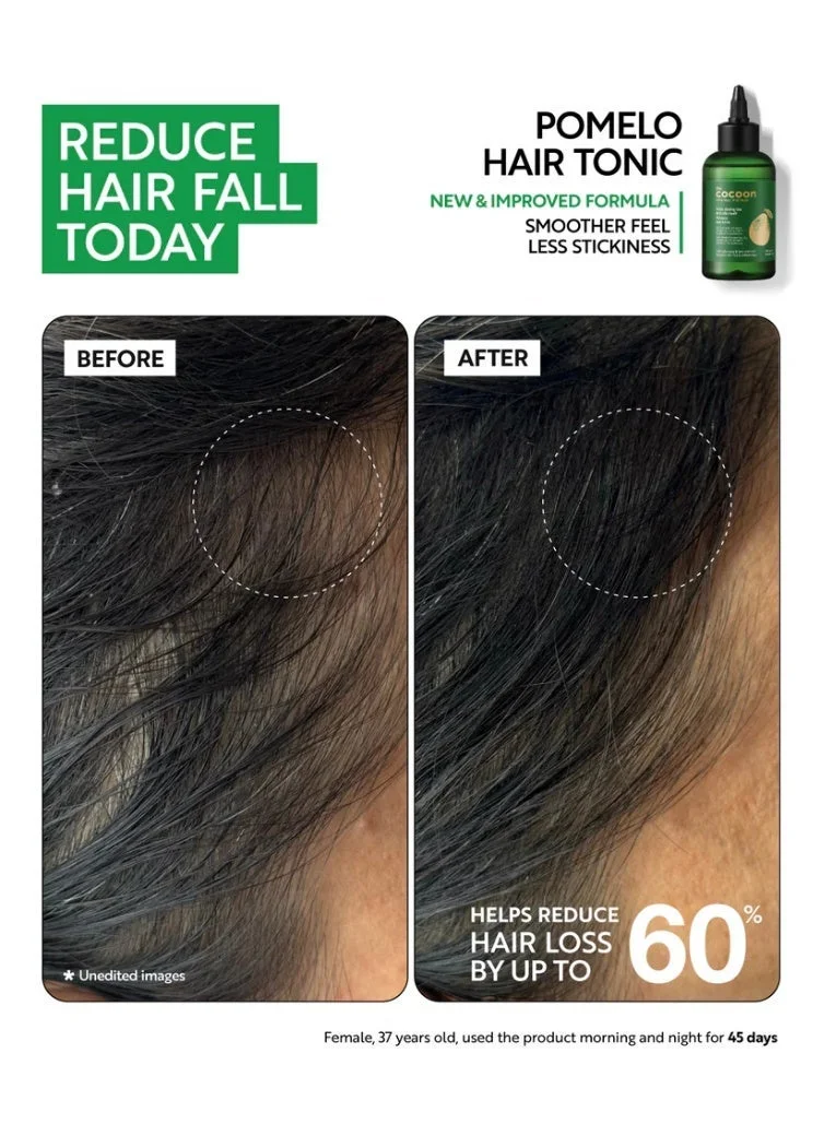 The Cocoon Original Vietnam 310 ml The Cocoon Original Vietnam Pomelo Hair Tonic, Anti Hair Loss Treatment, Hair Growth Serum, Softening Hair Care, Scalp Nourishing Tonic, Vegan Beauty, ELLE Beauty Award Winner, Natural Hair Oil,  | Best Price UAE