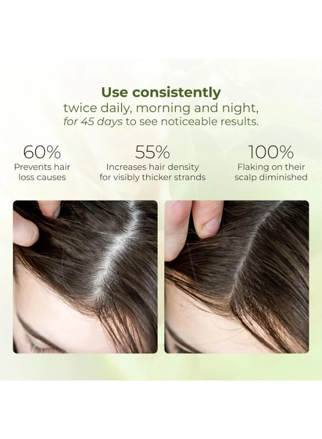 The Cocoon Original Vietnam 310 ml The Cocoon Original Vietnam Pomelo Hair Tonic, Anti Hair Loss Treatment, Hair Growth Serum, Softening Hair Care, Scalp Nourishing Tonic, Vegan Beauty, ELLE Beauty Award Winner, Natural Hair Oil,  | Best Price UAE