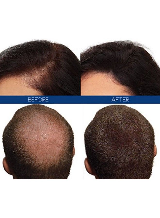 HAIR4REAL Hair Building Fibre Refill Brown 25 G - Image 3