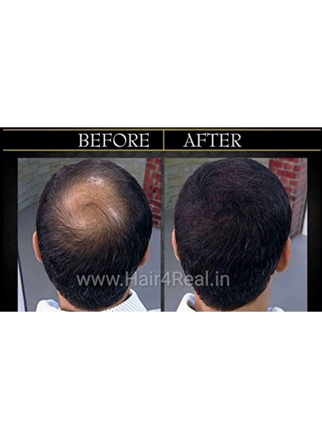 HAIR4REAL Hair Building Fibre Refill Brown 25 G - Image 4