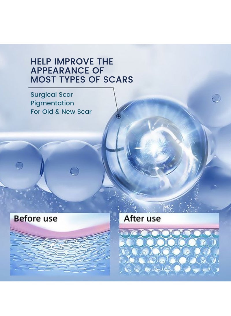 سوميفون كريم جل مزيل للندبات من بتركيبة عشبية لاخفاء الندوب وعلامات حب الشباب وتغذية البشرة الجافة وتجديد الرطوبة والترطيب العميق للجلد، 20 مل - Image 4