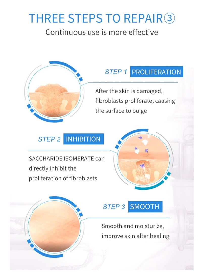 سوميفون كريم جل مزيل للندبات من بتركيبة عشبية لاخفاء الندوب وعلامات حب الشباب وتغذية البشرة الجافة وتجديد الرطوبة والترطيب العميق للجلد، 20 مل - Image 5