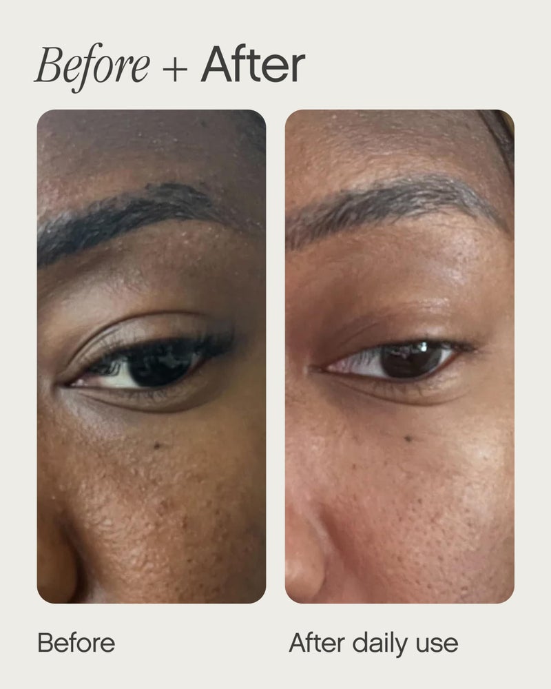 Topicals Sealed Active Scar Filling Primer for Acne Prone Skin - Good for Blemishes, Pores, Acne & Dryness - Contains Retinol and Salicylic Acid - 1 Oz - Image 3