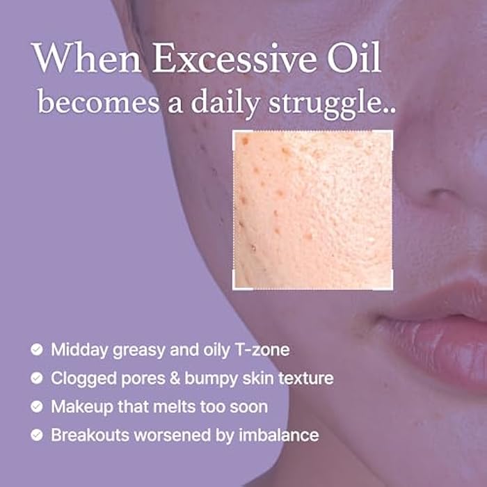 I'm from Black Rice Toner for Oily Skin, Sebum Control Toner, Lightweight, Niacinamide, Panthenol, Fragrance Free, Korean Skin Care, 150ml, 5.07 fl.oz - Image 3