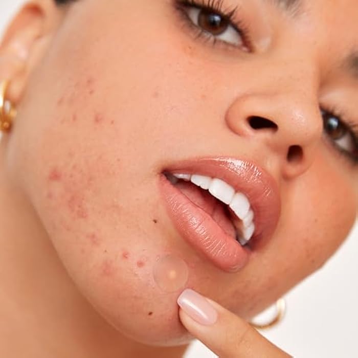 PEACE OUT Acne Healing Dots Helps Clear Blemishes Overnight, Fast Acting Hydrocolloid Pimple Patches for Breakouts with Salicylic Acid, Retinol and Aloe Vera, Award Winning Skincare Solution 20 Count - Image 4