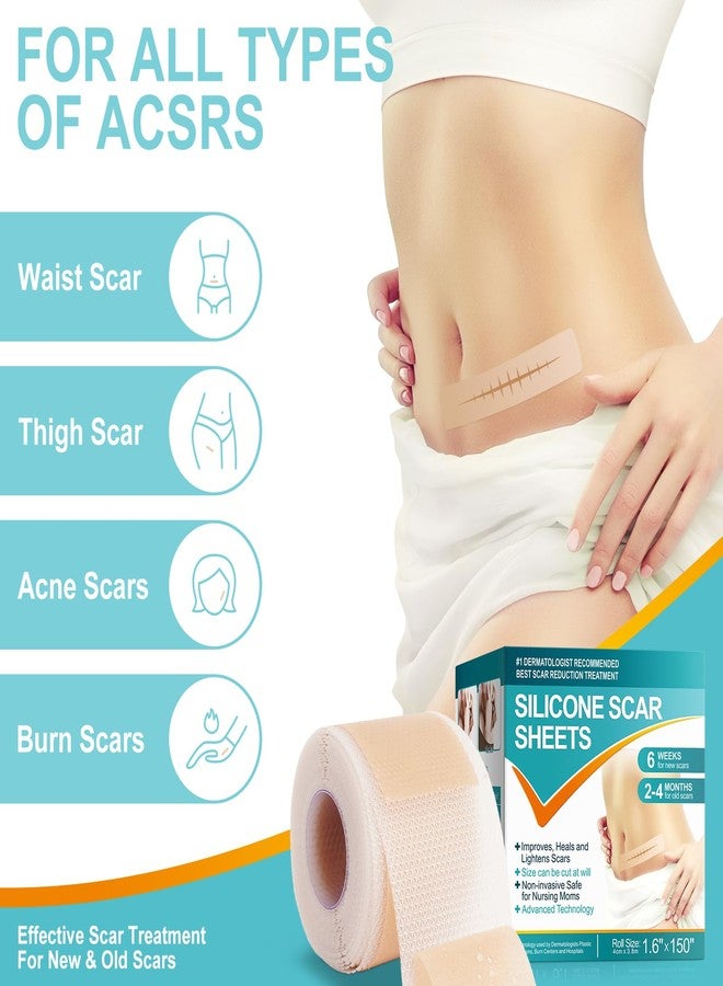 Silicone Scar Sheets (1.6” x 150” Roll-4cm x 3.8M), Scar Silicone Strips, Silicone Scar Tape Roll, Reusable, Professional Scar Removal Sheets for C-Section, Burn, Keloid, Surgery, Acne et - Image 3