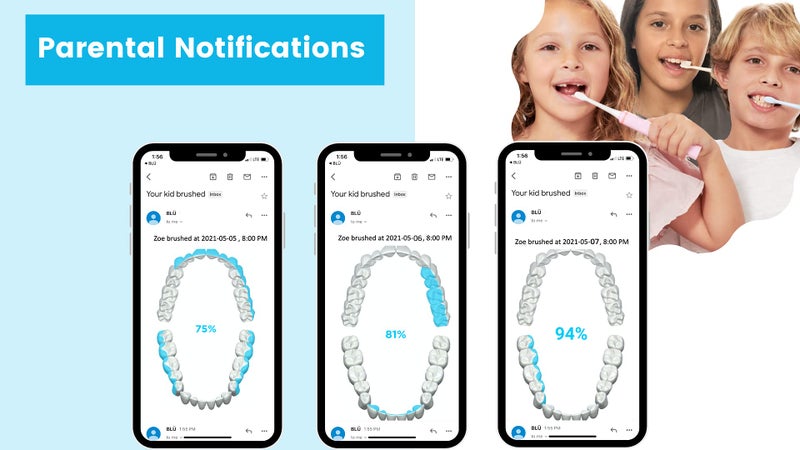 Blu Smart Bluetooth Enabled Kids Toothbrush with Live Tracking App to Teach Children Healthy Brushing Habits, Share Results with Your Dentist (Blue). Wireless Rechargeable Electric. - Image 5