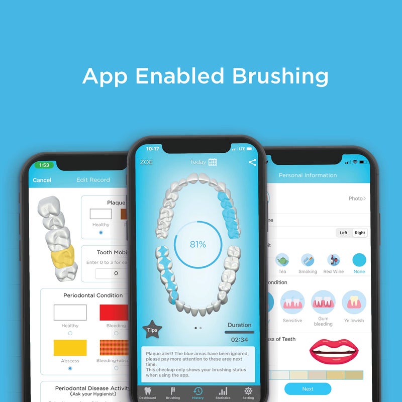 Blu Smart Bluetooth Enabled Kids Toothbrush with Live Tracking App to Teach Children Healthy Brushing Habits, Share Results with Your Dentist (Blue). Wireless Rechargeable Electric. - Image 2