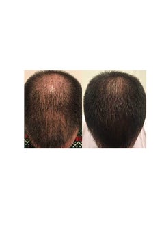 Zenagen Revolve Thickening Hair Loss Treatment for Men - pzsku/ZEF538DB6577953B0F45FZ/45/_/1738317436/f1a446fa-4712-4899-9ffc-827ae283fe9e