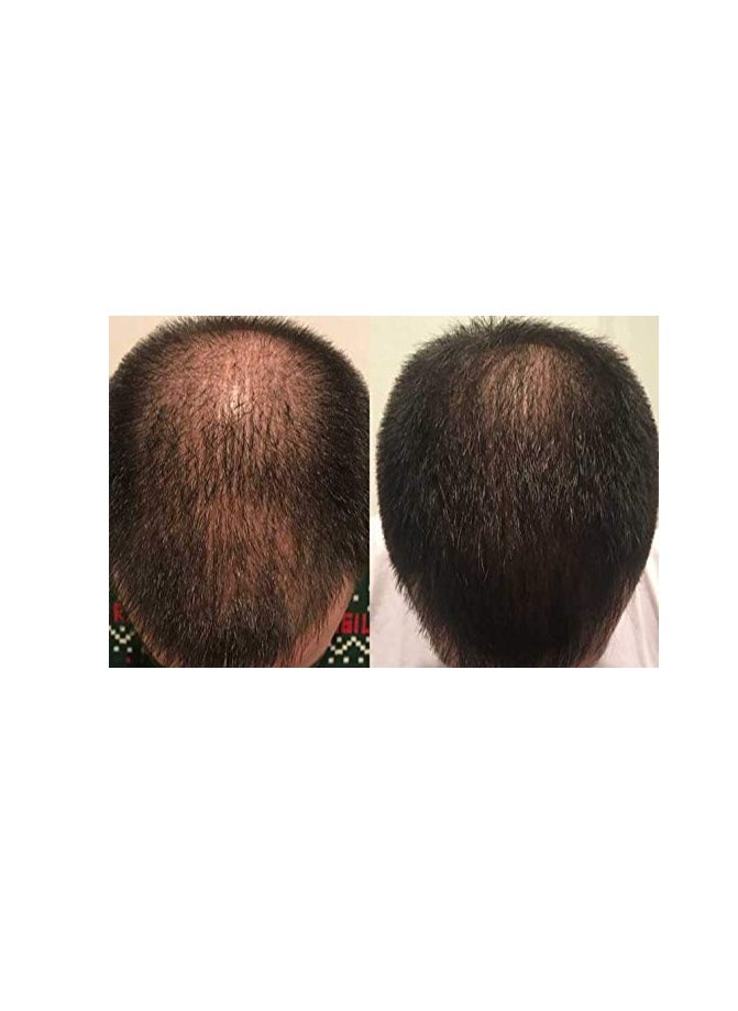 Zenagen Zenagen Revolve Thickening Hair Loss Treatment for Men  - Image 2