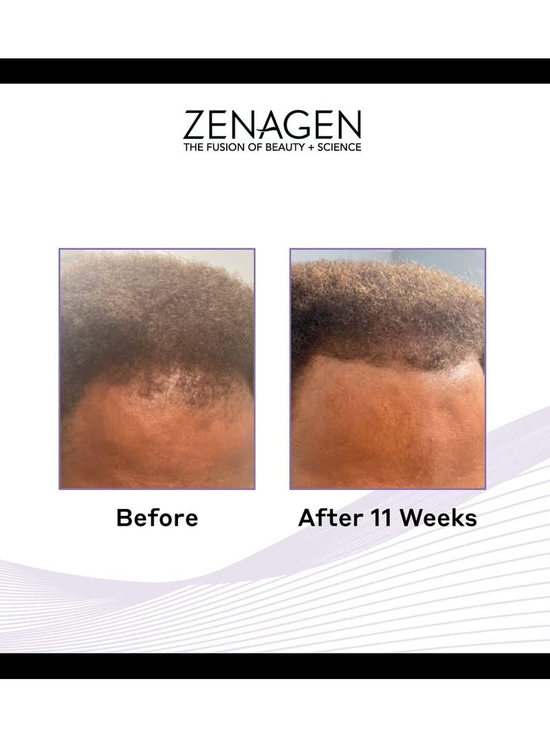 Zenagen Zenagen Revolve Thickening Hair Loss Treatment for Men  - Image 4