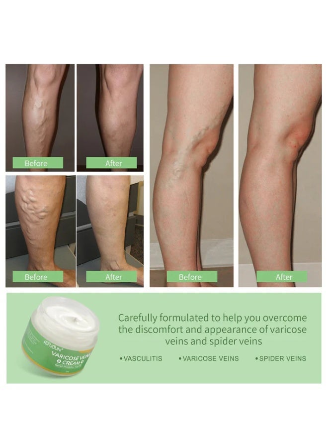 EELHOE Varicose Veins Cream 50g - Image 5