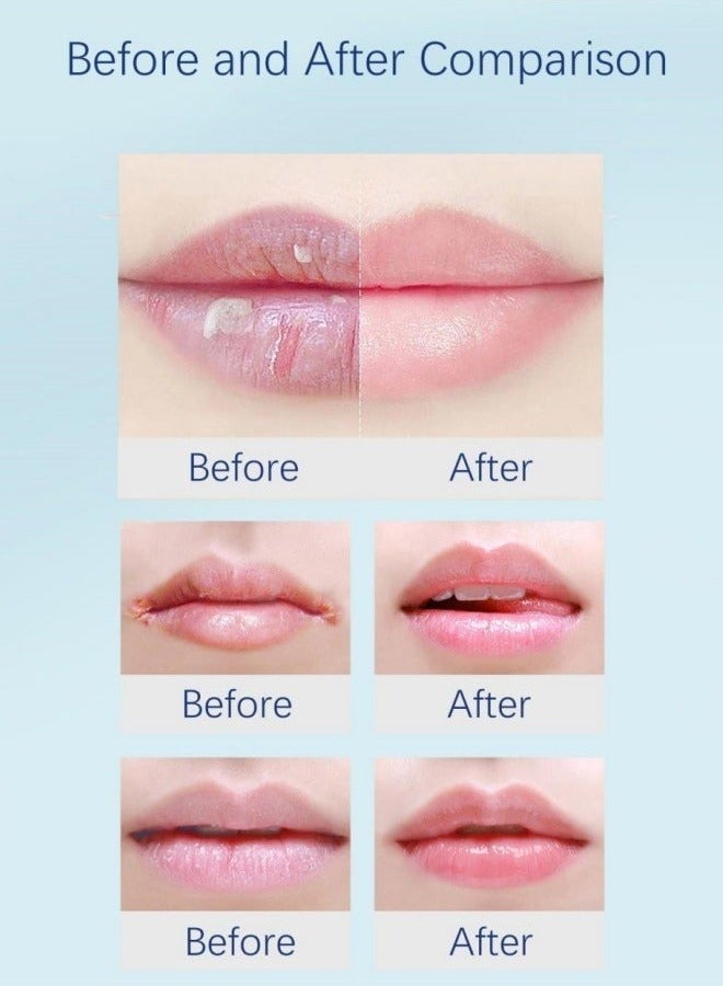 HEALMUSZ Lip Repair Gel Deep Moisturizing Hydrating Repairing Anti Drying Brightening Cold Compress Safe Lip Balm to Restore Lip Protection and Fade Lines and Improve Lip Color and Repair Cheilitis 20g - Image 4
