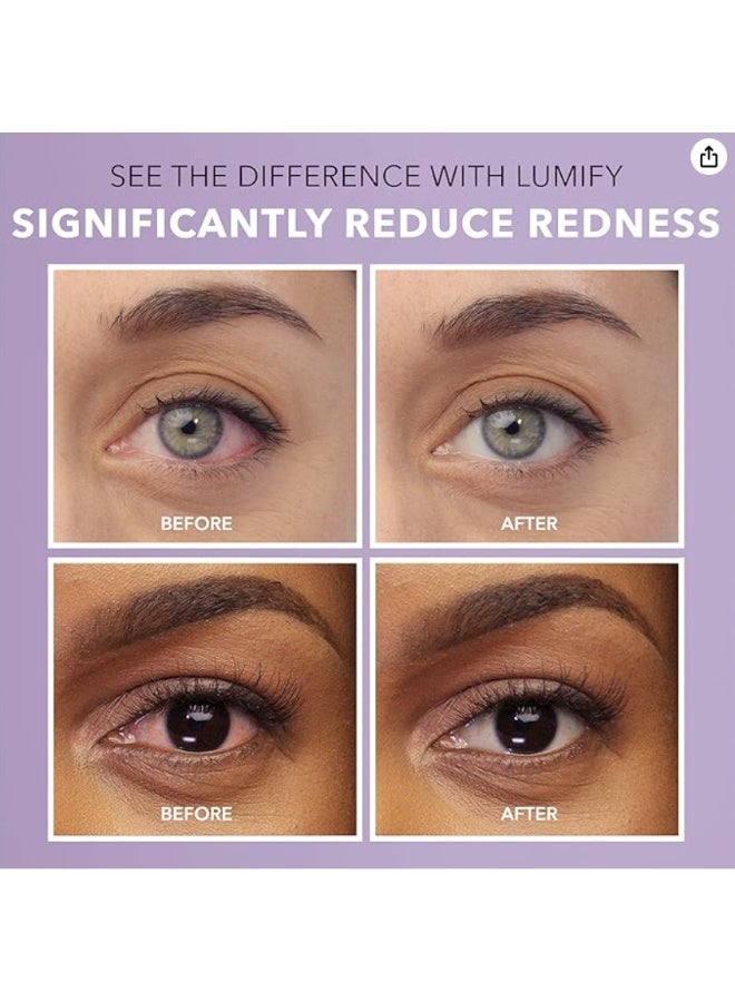 Lumify قطرات لوميفاي للعين 7.5 مل - Image 2