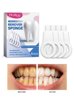 ORALHOE Teeth Stain Remover Sponge, Effective Tooth Whitener, Painless, No Sensitivity Teeth Cleaning Pen at Home Travel 4Pcs  - Image 1