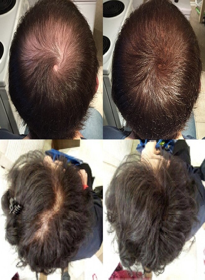 Nor1 Keratin Hair Building Fibers: Hair Fiber Filler and Thickener for Men and Women - Cover Up and Concealer for Thinning Areas or Minor Bald Spot - Thicker, Fuller Hair in Seconds - 25 grams - Image 2