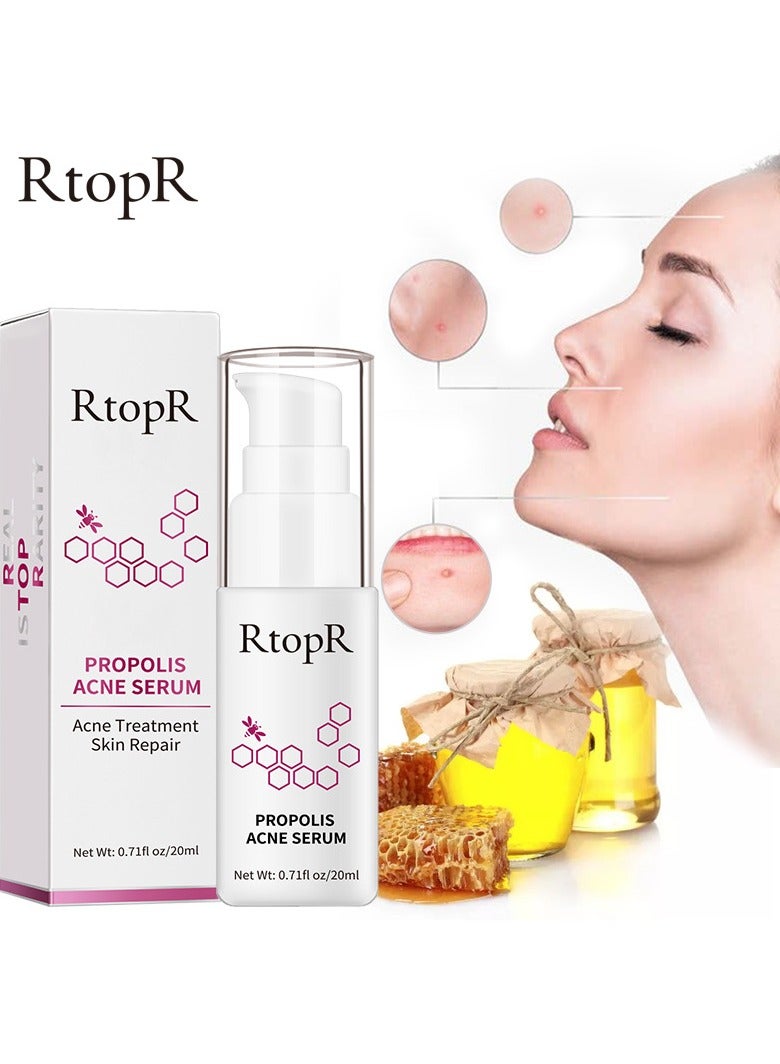 RtopR propolis anti-acne serum - Image 2