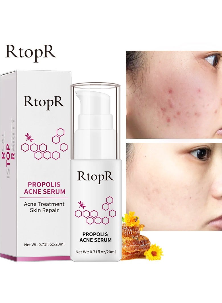 RtopR propolis anti-acne serum - Image 3