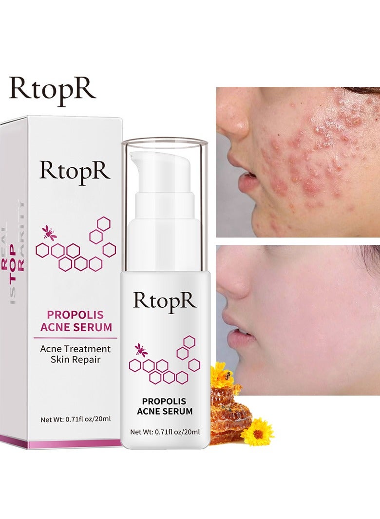 RtopR propolis anti-acne serum - Image 4