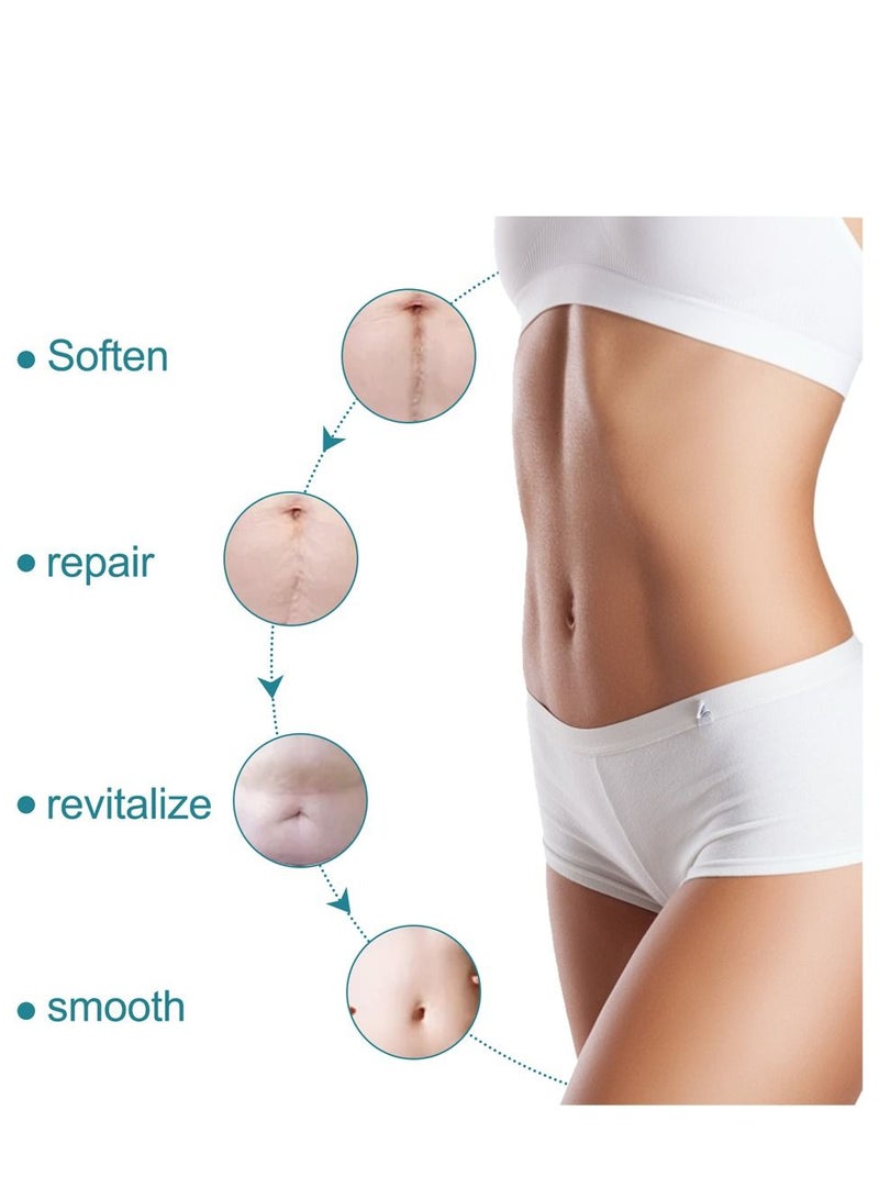 Elaimei Silicone Scar Sheets Scar Roll Sticker Self-Adhesive Scar Removal Sticker Medical Grade Silicone Roll,Silicone Scar Tape,Silicon Scar Gel Cream Patch Removes Abs Tuck Surgery Scar Scar Removal Strips 4CM*1.5M - Image 5