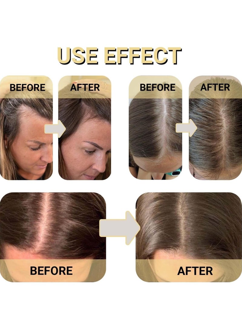 OUHOE Essential oils Essential Oil Solid Hair Hair Growth Oil Natural Hair Growth Oil Organic Oil For Hair Growth And Oil Suitable For Dry And Damaged Hair,60ML - Image 4