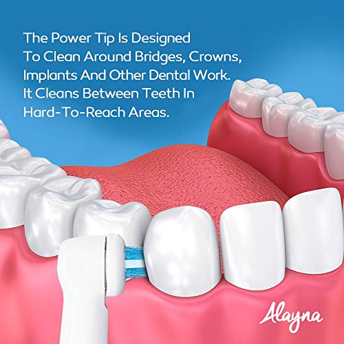 Alayna Oral B Replacement Brush Heads- Generic Oral-B Braun Professional Ortho Brush Head & Power Tip Kit- Pk. Of 4 Compatible Orthodontic Electric Toothbrush Heads - Image 4
