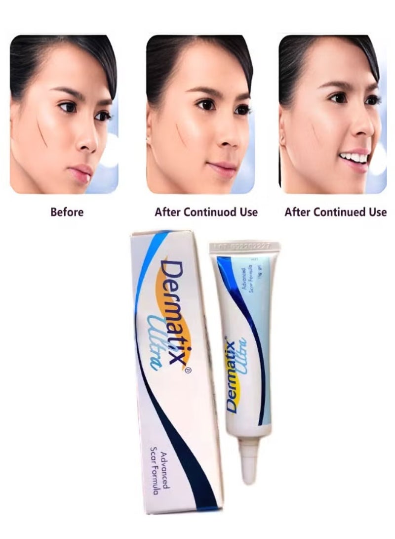 Dermatix جل متقدم للندبات 15 جرام لتحسين مظهر الندبات، يجف بسرعة وتركيبة جل سيليكون فريدة، يستخدم لعلاج الكيلويد والندبات الجراحية والندبات الضخامية، مناسب للبشرة الحساسة - Image 5