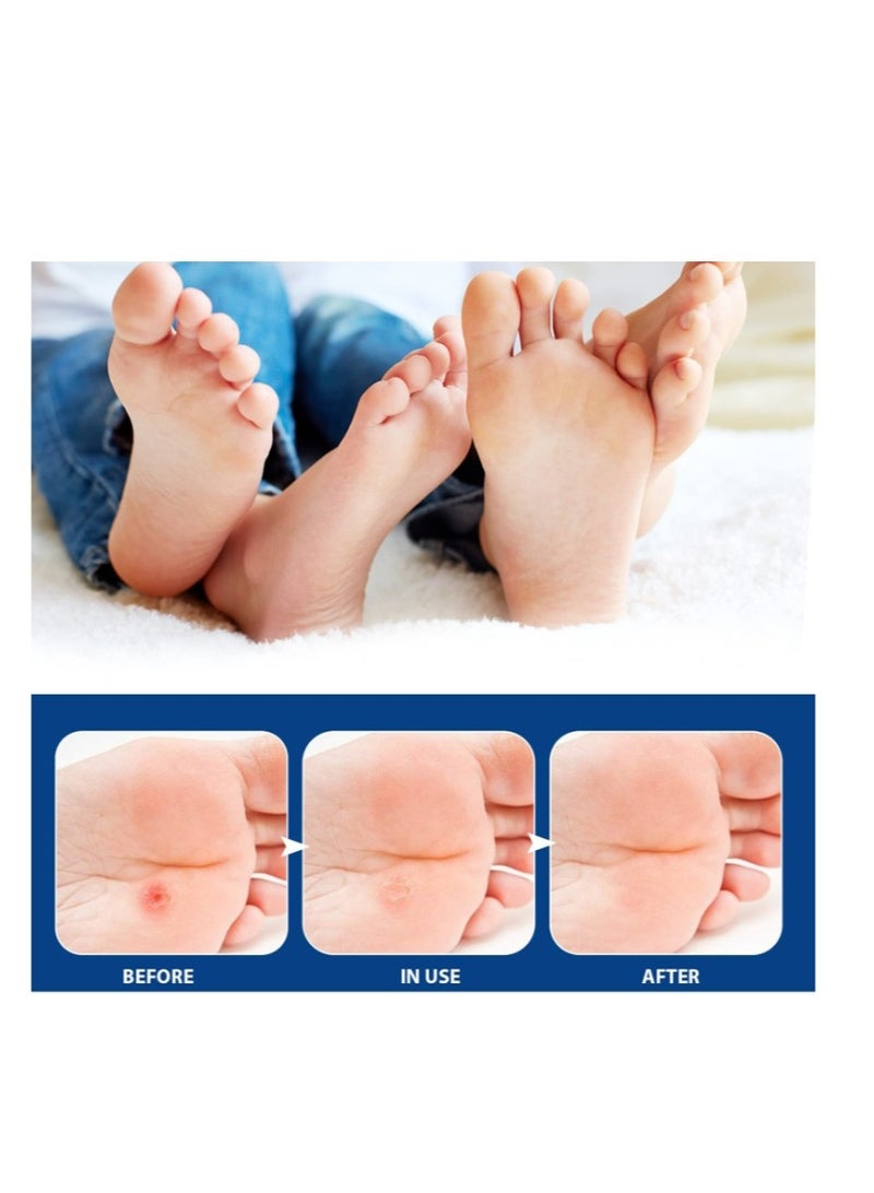 SOUTH MOON 24 Count Corn Removal Pads for Feet and Toe, Corn Feet Remover for Feet Extra Strength, Callous Remover - Image 3