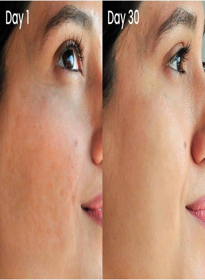 سوبر جوپ سوبرجووب! واقي شمسي غير لامع بعامل حماية من الشمس SPF 30 (20 مل) - واقي شمسي للوجه واسع الطيف يتحكم في لمعان البشرة مع لمسة نهائية غير لامعة وتأثير غير واضح، مثالي للبشرة الدهنية واستخدام برايمر الماكياج  - Image 5