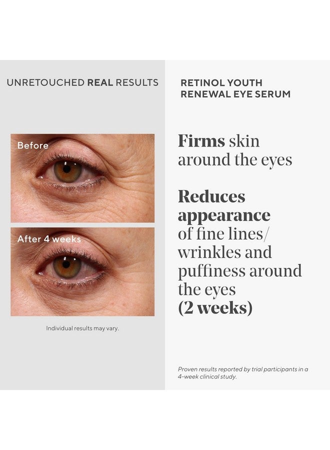 Murad Retinol Youth Renewal Eye Serum - Retinol Eye Serum Visibly Improves Undereye Puffiness Dark Circles and Reduces the Appearance of Fine Lines, Gentle Enough for Nightly Use - 0.5 oz - Image 3