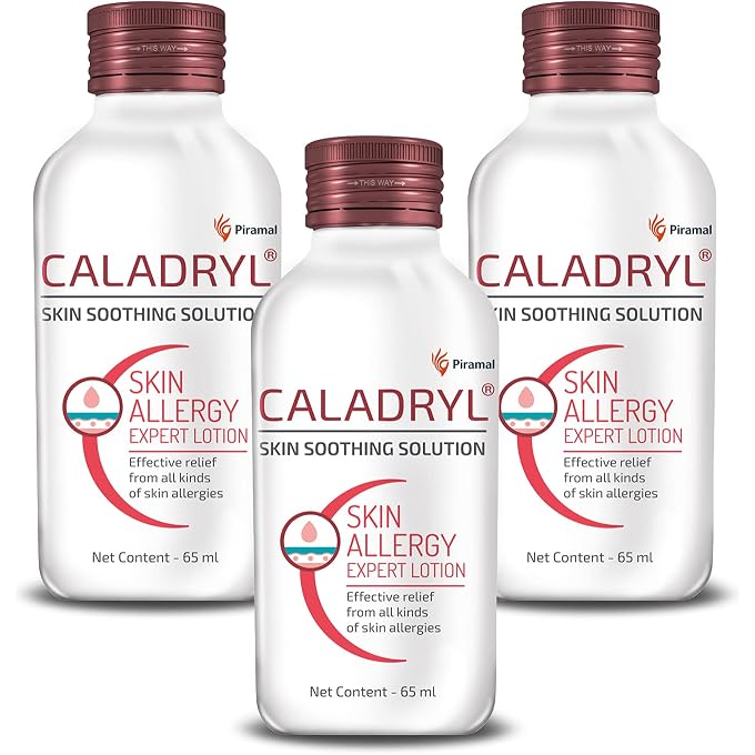 Caladryl Skin Allergy Expert Lotion for relief from skin rashes, sunburn, prickly heat, insect bites - Pack of 3 (3 x 65 ml) - Image 1