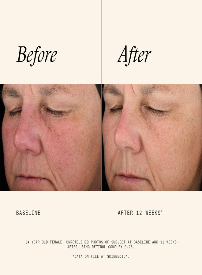 Skinmedica سكن ميديكيا ريتينول 0.25 كومبلكس - سيروم ريتينول للوجه، كريم ريتينول متقدم مضاد للشيخوخة يجدد البشرة ويقلل من ظهور الخطوط الدقيقة والتجاعيد، 1 أونصة سائلة - Image 3