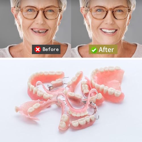 Brige Gum Material - for Repairing Missing Teeth and Smile Improvement. Parts of Partial or Full Dentures - Image 2
