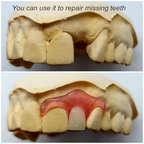 Brige Gum Material - for Repairing Missing Teeth and Smile Improvement. Parts of Partial or Full Dentures - Image 3