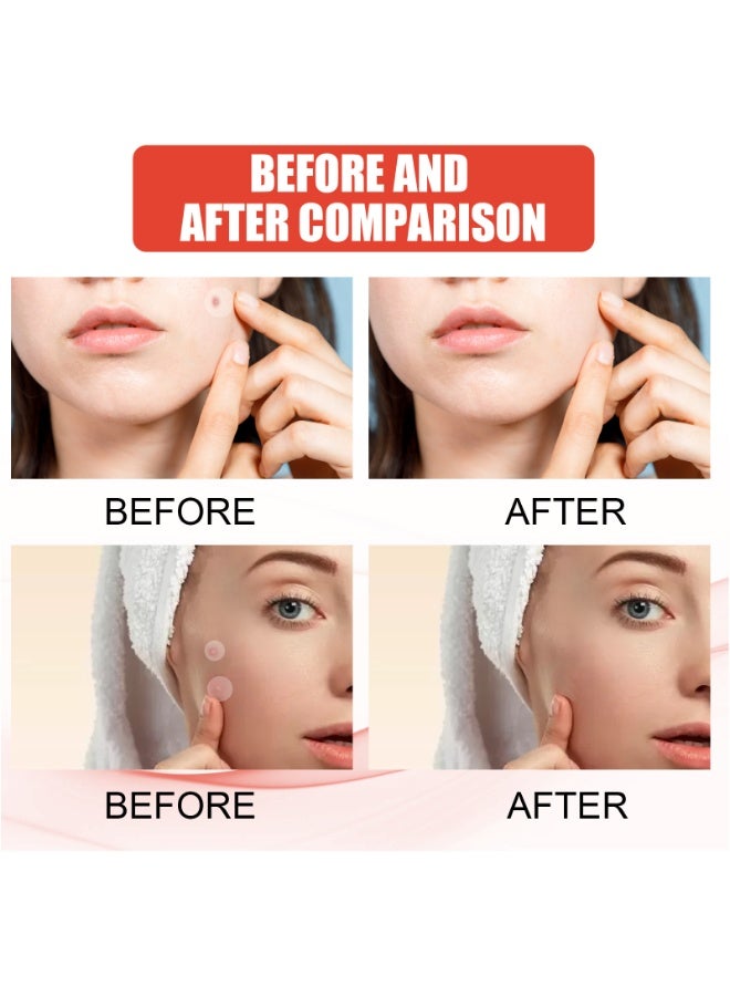الفولاذ المقاوم للصدأ gua sha -المعدن، يقلل من التورم، والصرف الليمفاوي، وتوتر الوجه، والأداة القوية gua sha الصلب المقاوم للصدأ - Image 4