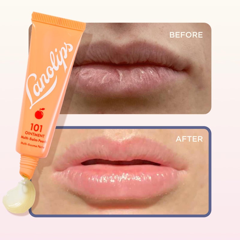 Lanolips 101 Ointment - Lanolin Lip Balm for Smooth, Hydrated & Healthy Lips - Multipurpose Ointment with Lanolin Oil for Dry Cuticles & More - Peach (0.52 oz) - Image 5