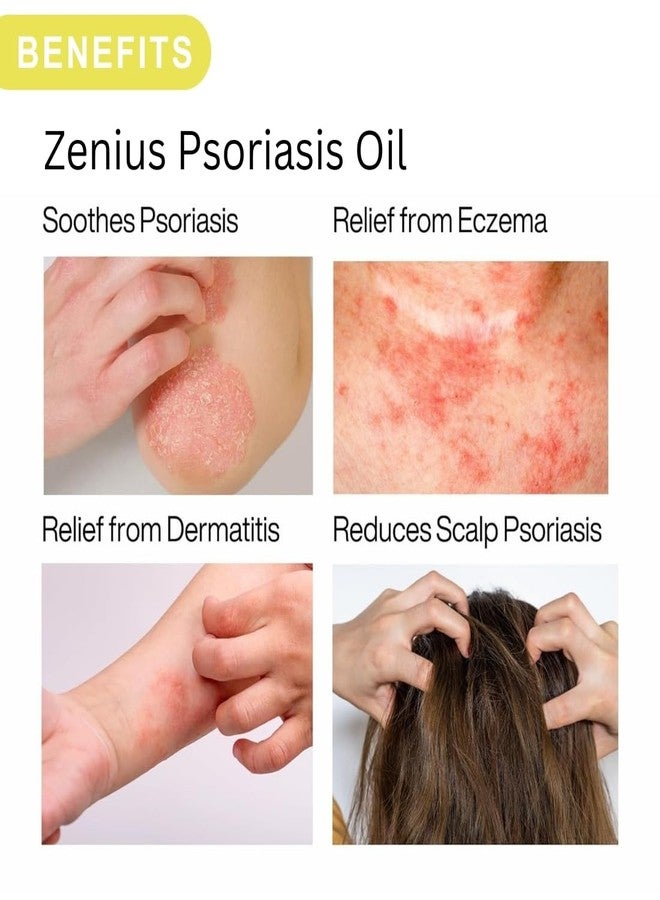 ZENIUS زيت لعلاج الصدفية الجلدية مع تركيبة عشبية لفروة الرأس، يخفف الحكة والاحمرار | سريع الامتصاص | يساعد على تهدئة الأكزيما والصدفية والتهاب الجلد وجفاف الجلد الشديد والقوباء الحلقية والالتهابات الفطرية | طبيعي ونقي 100% | 100 مل - Image 4