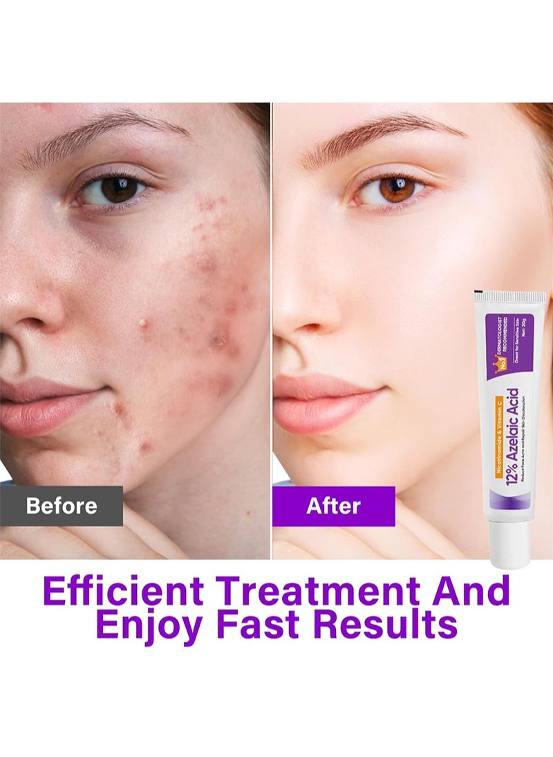 CARVENCHY - 12% Azelaic Acid Serum,Azelaic Acid Cream with Vitamin C and Niacinamide,Relieves Redness, Dark Spots, Rosacea,Repair Skin Discolouration,Balances Excess Sebum,Brightening Face Skin Care Treatment for All Skin Types 20g - Image 1