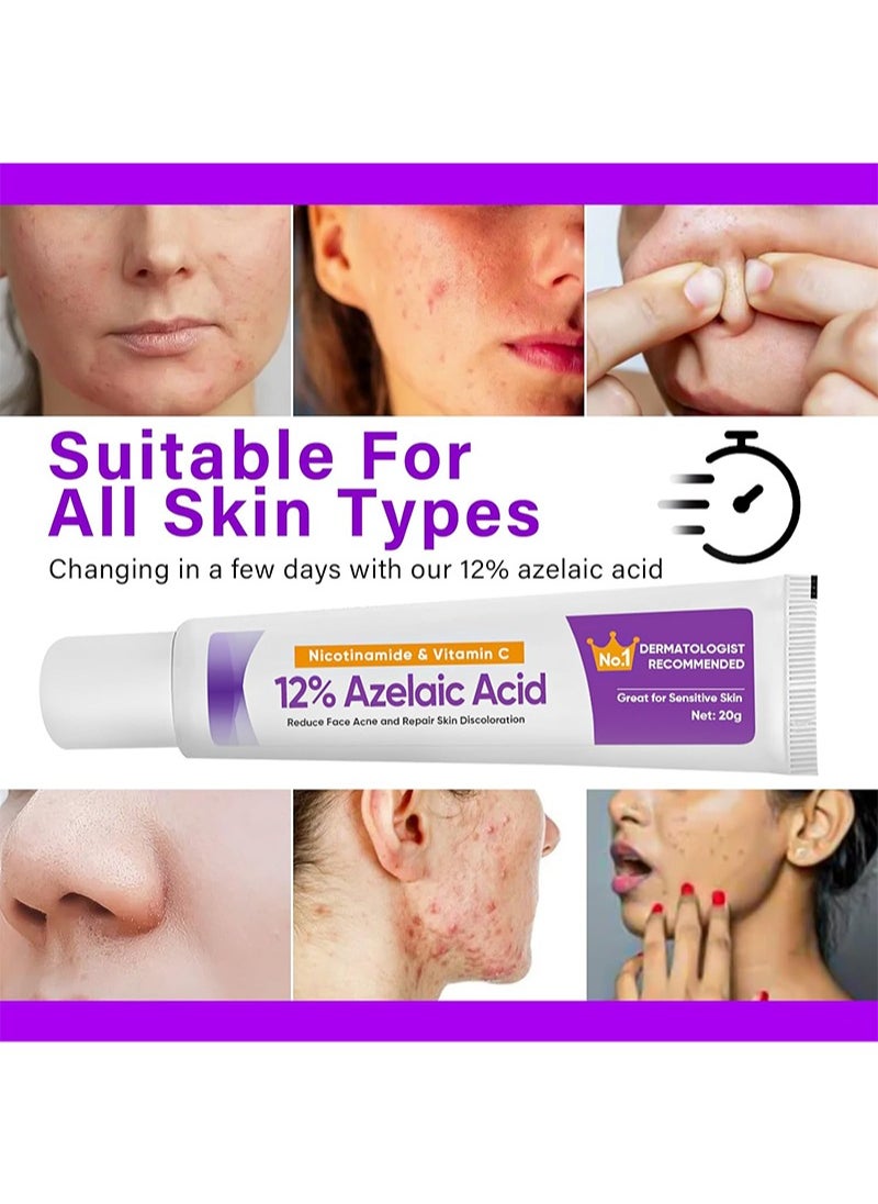 CARVENCHY - 12% Azelaic Acid Serum,Azelaic Acid Cream with Vitamin C and Niacinamide,Relieves Redness, Dark Spots, Rosacea,Repair Skin Discolouration,Balances Excess Sebum,Brightening Face Skin Care Treatment for All Skin Types 20g - Image 1