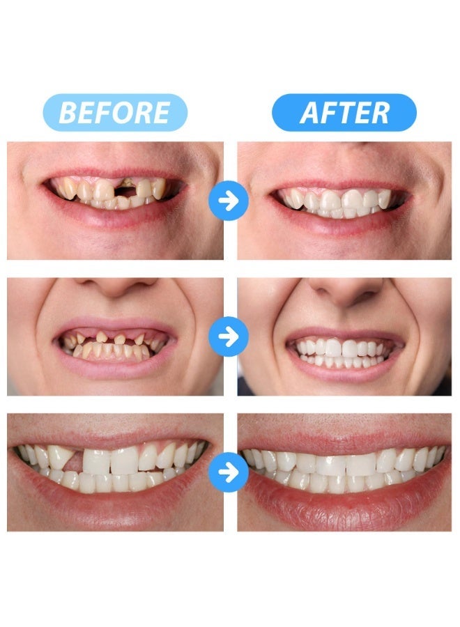 SOLARAE Tooth Filling Repair Kit, Temporary Tooth Filling Tooth Repair Kit with 4 Dental Tools Re-Usable Safe False Teeth for Temporary Filling Fixing Missing Broken Tooth - Image 2