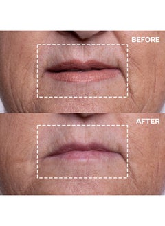WRINKLES SCHMINKLES Wrinkles Schminkles Mouth & Lip Wrinkle Patch - Reusable Silicone Smoothing Pads for Noticeable Wrinkle Reduction - Lip Wrinkle Prevention for Youthful, Smooth Skin (2 Pack)  - Image 3