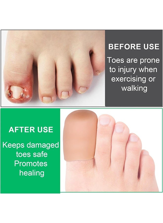 10 PCS Soft Gel Toe Caps Elastic Toe Protectors for Big Toe Toenail Cushions Toe Sleeves for Ingrown Toenails Missing Toenails, Corns, Calluses, Hammer Toes - Image 4