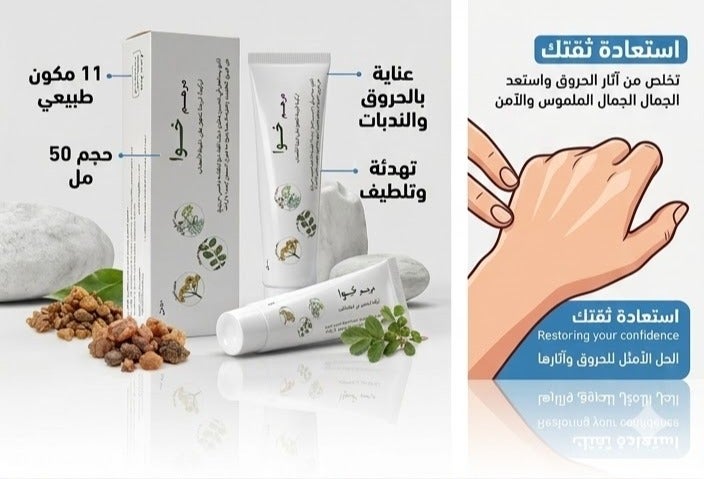كريم خوا جوا طبيعي من 9 نباتات مع زيت الزيتون – للعناية بالحروق والجروح والمساعدة في تقليل آثار الجلد وتهدئة البشرة - Image 2
