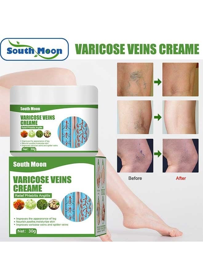 SOUTH MOON - Varicose Veins Cream to Relieve Phlebitis Angiitis, Strengthen Capillary Health, Relieve Swelling Pain and Fatigue, Minimize Varicose Vein and Spider Vein Leg Care Massage Cream 30g - Image 1