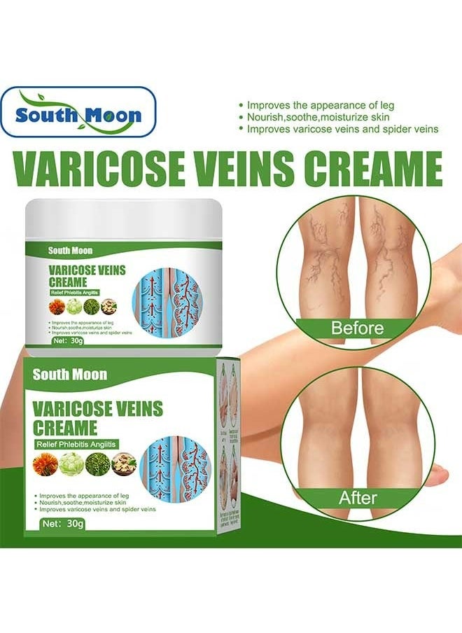 SOUTH MOON - Varicose Veins Cream to Relieve Phlebitis Angiitis, Strengthen Capillary Health, Relieve Swelling Pain and Fatigue, Minimize Varicose Vein and Spider Vein Leg Care Massage Cream 30g - Image 1