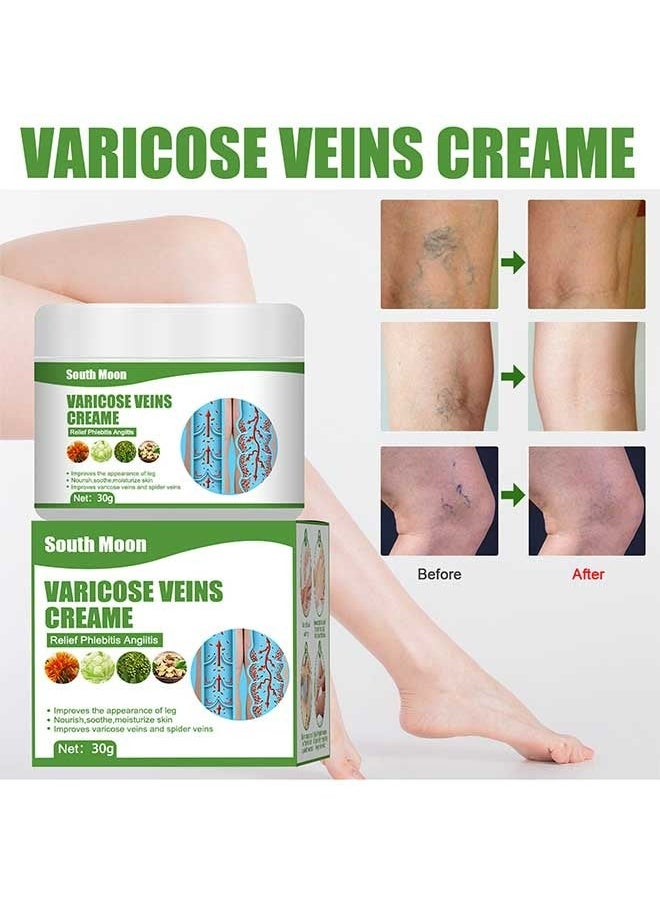 SOUTH MOON - Varicose Veins Cream to Relieve Phlebitis Angiitis, Strengthen Capillary Health, Relieve Swelling Pain and Fatigue, Minimize Varicose Vein and Spider Vein Leg Care Massage Cream 30g - Image 1