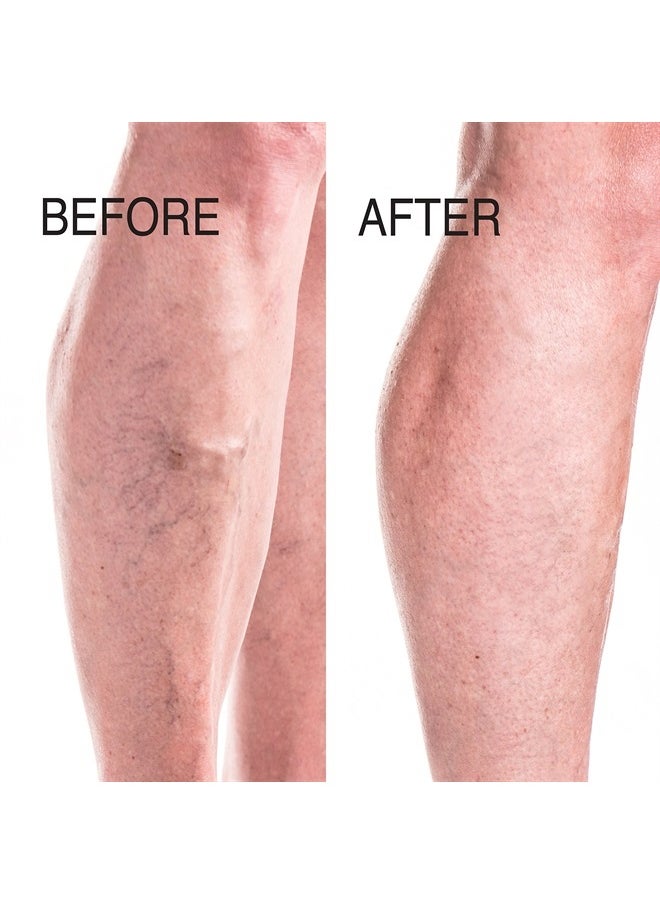 Advanced Clinicals Vein Care Leg Cream For Varicose Veins & Spider Veins, Collagen & Arnica Skin Care Therapy Firming Vein Lotion Helps Visibly Diminish Varicose Vein For Legs, Body, & Arms, 8 Fl Oz  - Image 3