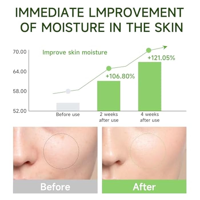 Gaayou Centella Asiatica Serum Centella Tea Tree Ampoule Facial Serum Korean Centella Serum for Acne-Prone Oil Skin Soothing, Calming, Reduce Redness 105ml - Image 4