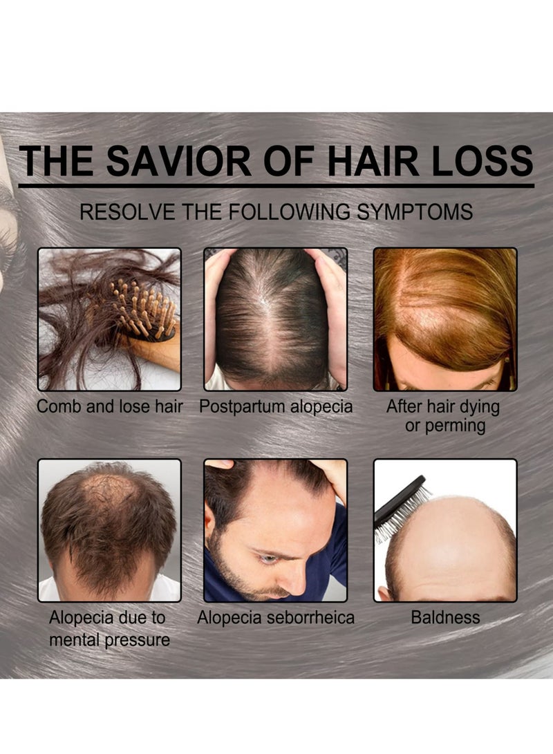 EELHOE 30ml Rosemary Hair Growth Essential Oil Prevent Hair Loss Nourish Scalp Strengthen Hair - Image 4